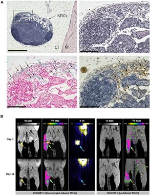 Nanoparticles for Stem Cell Tracking and the Potential Treatment of Cardiovascular Diseases